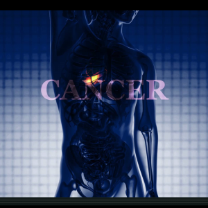 Cancer as a Metabolic Disease: Innovative Practical Approach -Online Lecture